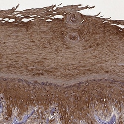 KRT9 Antibody, Novus Biologicals 25 &mu;L, Unlabeled:Antibodies, Polyclonal